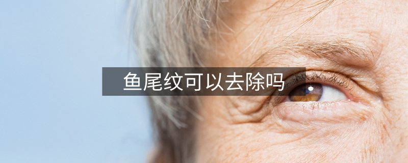 鱼尾纹可以去除吗