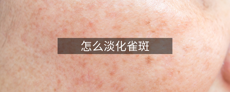 怎么淡化雀斑