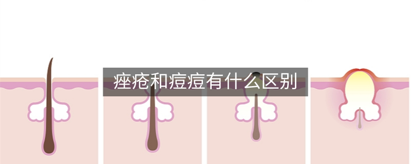 痤疮和痘痘有什么区别