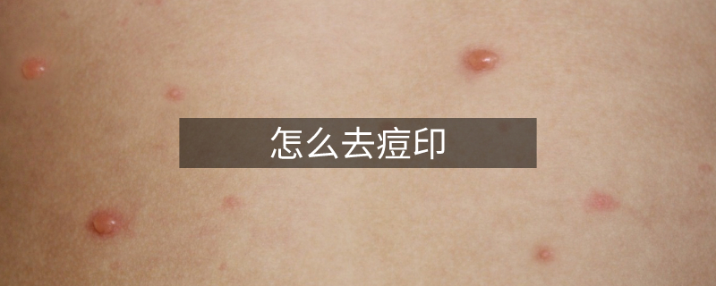 怎么去痘印 怎么去痘印