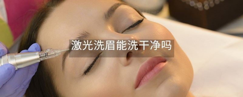 激光洗眉能洗干净吗 激光洗眉能洗干净吗