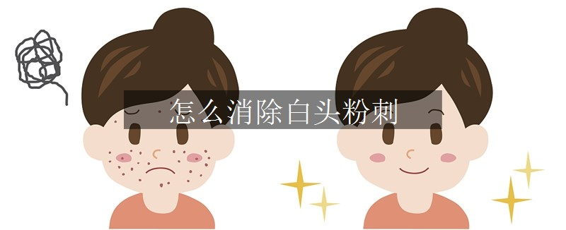 怎么消除白头粉刺