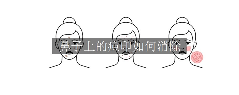 鼻子上的痘印如何消除