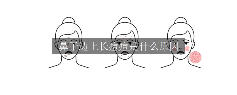 鼻子边上长痘痘是什么原因