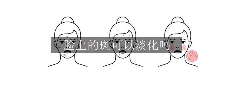 脸上的斑可以淡化吗