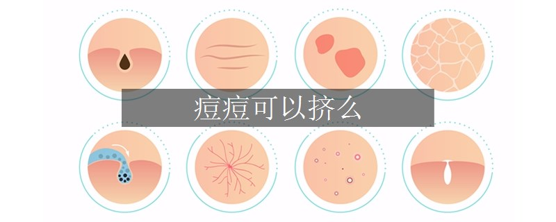 痘痘可以挤么