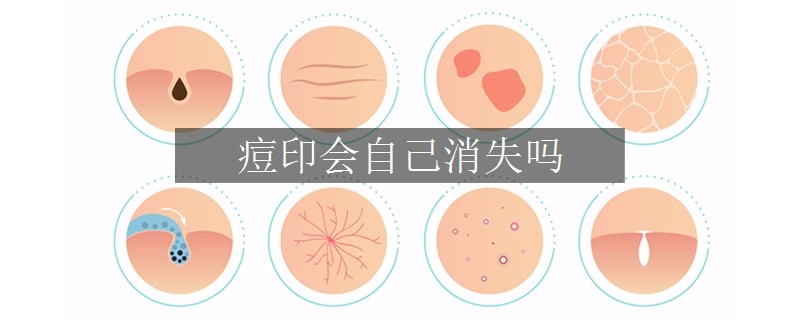 痘印会自己消失吗