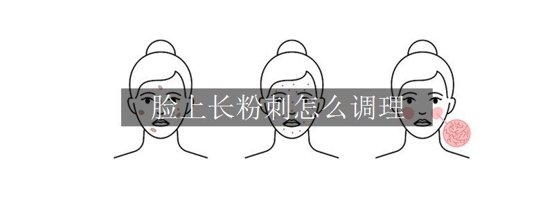 脸上长粉刺怎么调理