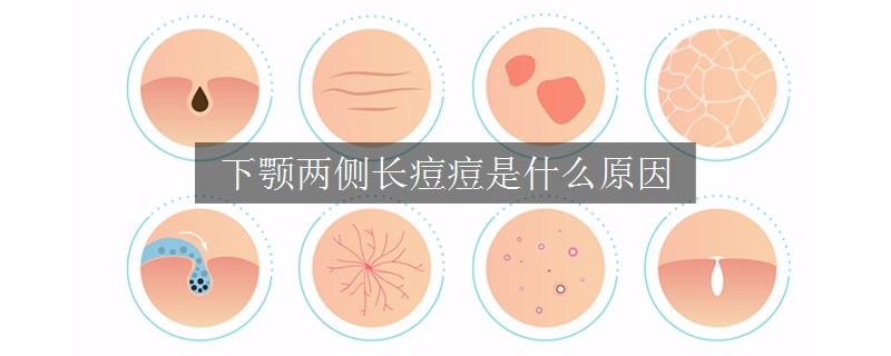 下颚两侧长痘痘是什么原因