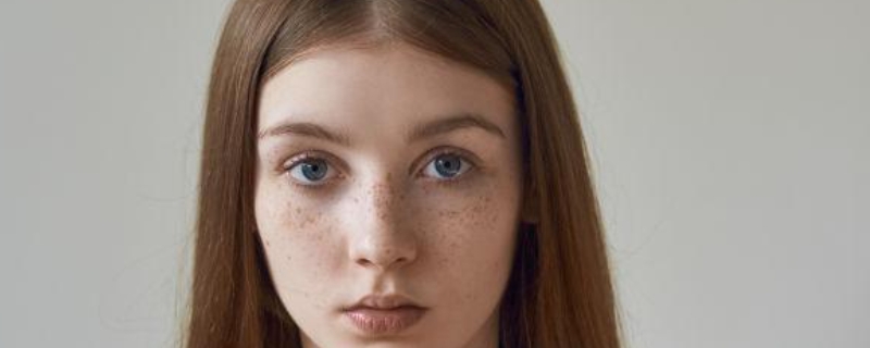 女孩脸上有雀斑怎么办 女孩脸上有雀斑怎么办