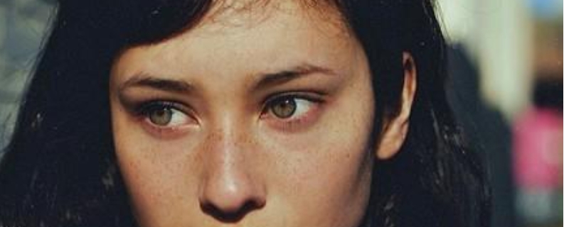 女孩脸上有雀斑怎么办 女孩脸上有雀斑怎么办